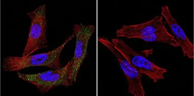 Anti-P-Cadherin antibody [6A9] used in Immunocytochemistry/ Immunofluorescence (ICC/IF). GTX19350