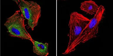 Anti-P-Cadherin antibody [6A9] used in Immunocytochemistry/ Immunofluorescence (ICC/IF). GTX19350