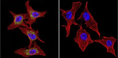 Anti-P-Cadherin antibody [6A9] used in Immunocytochemistry/ Immunofluorescence (ICC/IF). GTX19350