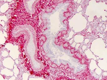 Anti-Collagen I antibody used in IHC (Paraffin sections) (IHC-P). GTX20292