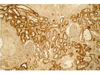 Anti-Collagen I antibody used in IHC (Paraffin sections) (IHC-P). GTX20292