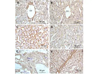 Anti-Collagen I antibody used in IHC (Paraffin sections) (IHC-P). GTX20292