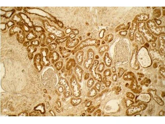 Anti-Collagen I antibody used in IHC (Paraffin sections) (IHC-P). GTX20292