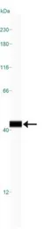 Anti-ARA9 antibody [35-2] used in Western Blot (WB). GTX20468