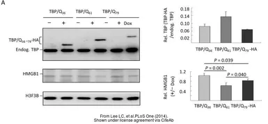 Anti-TBP antibody [1TBP18] used in Western Blot (WB). GTX20818