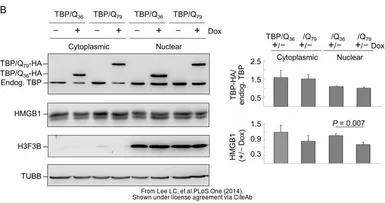 Anti-TBP antibody [1TBP18] used in Western Blot (WB). GTX20818