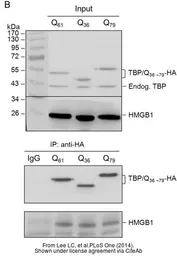 Anti-TBP antibody [1TBP18] used in Western Blot (WB). GTX20818
