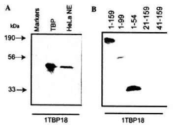 Anti-TBP antibody [1TBP18] used in Western Blot (WB). GTX20818