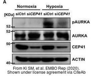 Goat Anti-Rabbit IgG antibody (HRP). GTX213110-01