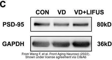 Goat Anti-Rabbit IgG antibody (HRP). GTX213110-01