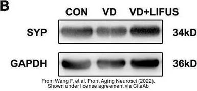 Goat Anti-Mouse IgG antibody (HRP). GTX213111-01