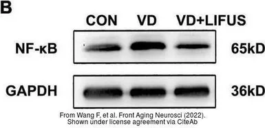 Goat Anti-Mouse IgG antibody (HRP). GTX213111-01