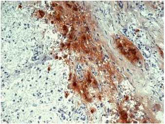 Anti-beta Endorphin antibody [B31.15] used in IHC (Frozen sections) (IHC-Fr). GTX21419