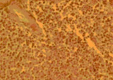 Anti-CCR4 antibody used in Immunohistochemistry (IHC). GTX21669