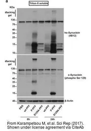 Anti-alpha Synuclein antibody [4B12] used in Western Blot (WB). GTX21904