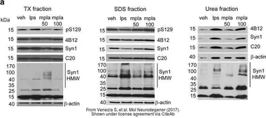 Anti-alpha Synuclein antibody [4B12] used in Western Blot (WB). GTX21904