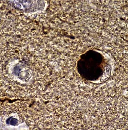 Anti-alpha Synuclein antibody [4B12] used in Immunohistochemistry (IHC). GTX21904