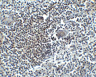 Anti-CXCR4 antibody used in IHC (Paraffin sections) (IHC-P). GTX22074