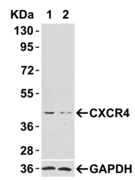 Anti-CXCR4 antibody used in Western Blot (WB). GTX22074