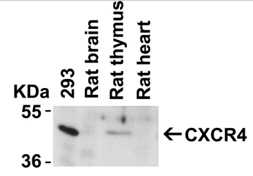 Anti-CXCR4 antibody used in Western Blot (WB). GTX22074