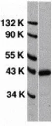 Anti-CXCR4 antibody used in Western Blot (WB). GTX22074