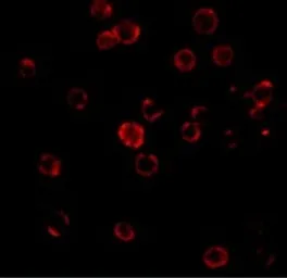 Anti-CXCR4 antibody used in Immunocytochemistry/ Immunofluorescence (ICC/IF). GTX22074