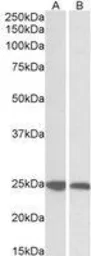 Anti-GRB2 antibody used in Western Blot (WB). GTX22234