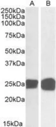 Anti-GRB2 antibody used in Western Blot (WB). GTX22234