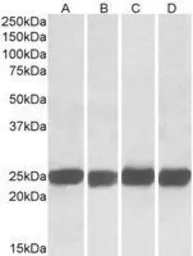 Anti-GRB2 antibody used in Western Blot (WB). GTX22234