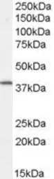 Anti-Dysadherin antibody used in Western Blot (WB). GTX22248