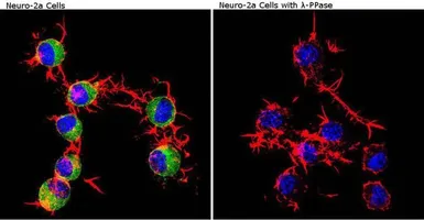 Anti-CaMKII alpha (phospho Thr286) antibody [22B1] used in Immunocytochemistry/ Immunofluorescence (ICC/IF). GTX22724