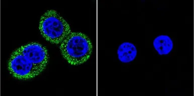 Anti-CaMKII alpha (phospho Thr286) antibody [22B1] used in Immunocytochemistry/ Immunofluorescence (ICC/IF). GTX22724