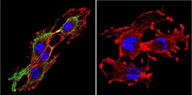 Anti-Prolactin Receptor antibody [T6] used in Immunocytochemistry/ Immunofluorescence (ICC/IF). GTX22773