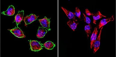 Anti-Prolactin Receptor antibody [T6] used in Immunocytochemistry/ Immunofluorescence (ICC/IF). GTX22773