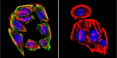 Anti-Prolactin Receptor antibody [T6] used in Immunocytochemistry/ Immunofluorescence (ICC/IF). GTX22773