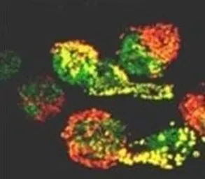 Anti-Prolactin Receptor antibody [T6] used in Immunocytochemistry/ Immunofluorescence (ICC/IF). GTX22773