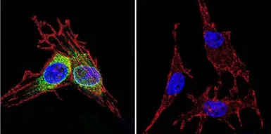 Anti-Hsp70 antibody [5A5] used in Immunocytochemistry/ Immunofluorescence (ICC/IF). GTX22787