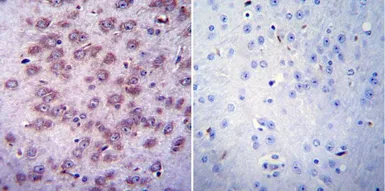 Anti-AChR antibody [88B] used in IHC (Paraffin sections) (IHC-P). GTX22804