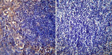 Anti-AChR antibody [88B] used in IHC (Paraffin sections) (IHC-P). GTX22804