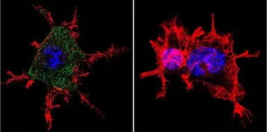 Anti-AChR antibody [88B] used in Immunocytochemistry/ Immunofluorescence (ICC/IF). GTX22804