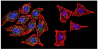 Anti-AChR antibody [88B] used in Immunocytochemistry/ Immunofluorescence (ICC/IF). GTX22804