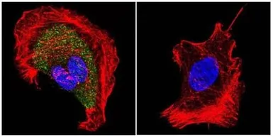 Anti-AChR antibody [88B] used in Immunocytochemistry/ Immunofluorescence (ICC/IF). GTX22804