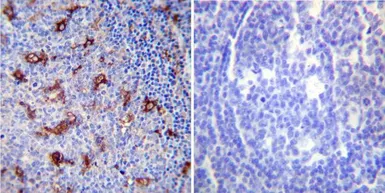 Anti-SERCA2 ATPase antibody [IID8] used in IHC (Paraffin sections) (IHC-P). GTX22817