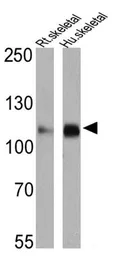 Anti-SERCA2 ATPase antibody [IID8] used in Western Blot (WB). GTX22817