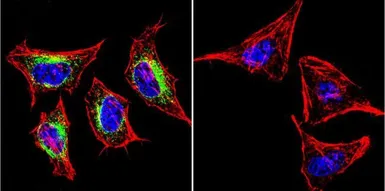 Anti-SERCA2 ATPase antibody [IID8] used in Immunocytochemistry/ Immunofluorescence (ICC/IF). GTX22817