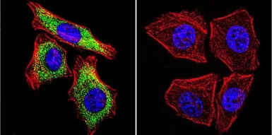 Anti-SERCA2 ATPase antibody [IID8] used in Immunocytochemistry/ Immunofluorescence (ICC/IF). GTX22817