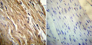 Anti-Calsequestrin antibody [VIIID12] used in IHC (Paraffin sections) (IHC-P). GTX22824