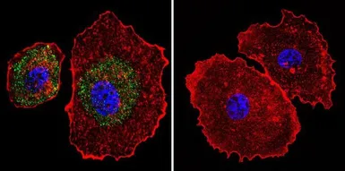 Anti-Calsequestrin antibody [VIIID12] used in Immunocytochemistry/ Immunofluorescence (ICC/IF). GTX22824