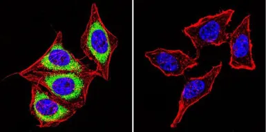 Anti-Calsequestrin antibody [VIIID12] used in Immunocytochemistry/ Immunofluorescence (ICC/IF). GTX22824