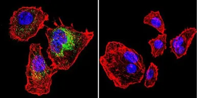 Anti-Calsequestrin antibody [VIIID12] used in Immunocytochemistry/ Immunofluorescence (ICC/IF). GTX22824